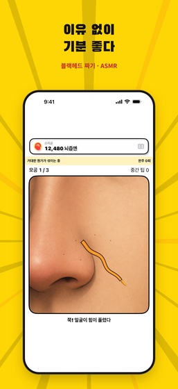 블랙헤드 짜기 화면