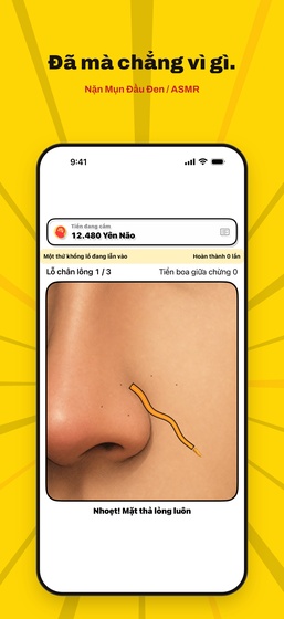 Màn hình Nặn Mụn Đầu Đen